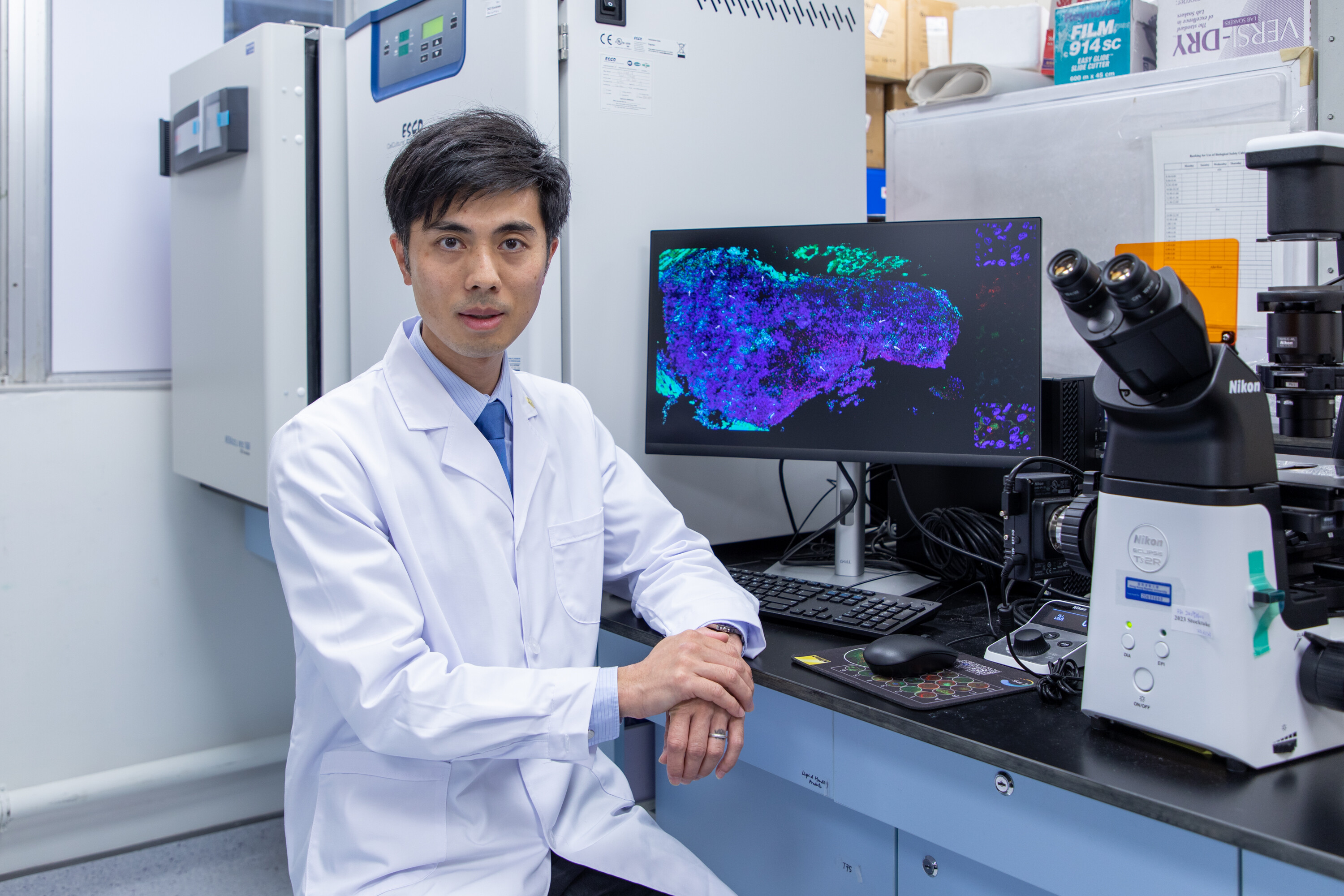 A collaborative research team led by Dr Allen Cheung Ka-loon, Assistant Professor of the Department of Biology at HKBU, has investigated the detection of HCMV in urine for the continuous monitoring of end-organ disease risk in HIV-1 patients.