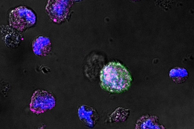浸大研究揭示检验尿液中的人类巨细胞病毒能有效推算早期HIV-1患者罹患终端器官疾病之机率